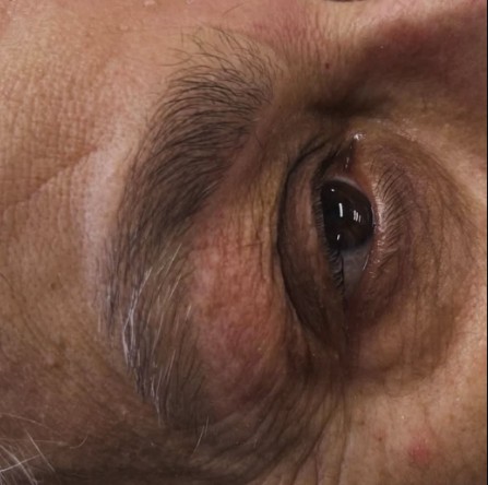 Eyebrow threading result on mature client